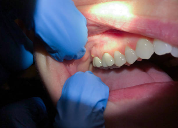 Best Emergency Gum Pain Relief  in Morgantown, PA